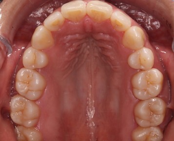 Caso2 - despues Caso2 - despues