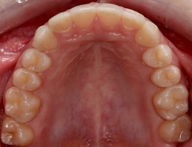 Caso4- despues Caso4- despues